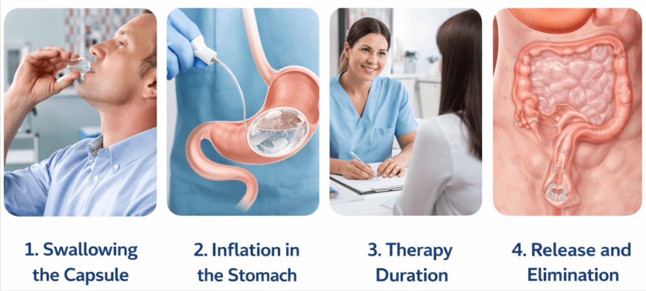 How Does the Capsule Work